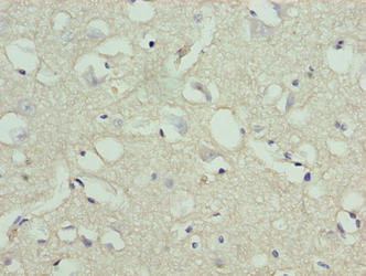 Immunohistochemistry of paraffin-embedded human brain tissue using STOX1 Antibody at dilution of 1:100Rabbit anti-Human STOX1 Polyclonal Antibody