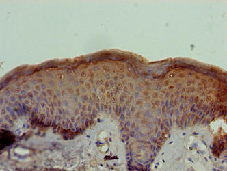 Immunohistochemistry of paraffin-embedded human skin tissue using STOX1 Antibody at dilution of 1:100Rabbit anti-Human STOX1 Polyclonal Antibody