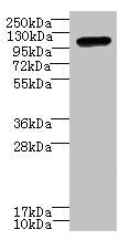 Western blot  | All lanes: STOX1 antibody at 8µg/ml + HepG2 whole cell lysate  | Secondary  | Goat polyclonal to rabbit IgG at 1/10000 dilution  | Predicted band size: 111, 26, 20 kDa  | Observed band size: 111 kDaRabbit anti-Human STOX1 Polyclonal Antibody