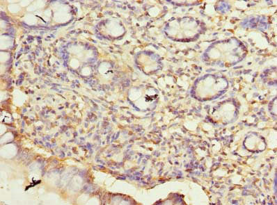 Immunohistochemistry of paraffin-embedded human small intestine tissue using ARMCX6 Antibody at dilution of 1:100Rabbit anti-Human ARMCX6 Polyclonal Antibody