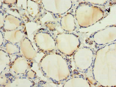 Immunohistochemistry of paraffin-embedded human thyroid tissue using ARMCX6 Antibody at dilution of 1:100Rabbit anti-Human ARMCX6 Polyclonal Antibody