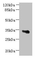 Western blot  | All lanes: ARMCX6 antibody at 1.3µg/ml + U251 whole cell lysate  | Secondary  | Goat polyclonal to rabbit IgG at 1/10000 dilution  | Predicted band size: 34 kDa  | Observed band size: 34 kDa