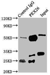 Immunoprecipitating PEX26 in K562 whole cell lysate  | Lane 1: Rabbit control IgG instead of PEX26 Antibody in K562 whole cell lysate. For western blotting, a HRP-conjugated Protein G antibody was used as the secondary antibody (1/2000)  | Lane 2: PEX26 Antibody (6µg) + K562 whole cell lysate (500µg)  | Lane 3: K562 whole cell lysate (20µg)Rabbit anti-Human PEX26 Polyclonal Antibody
