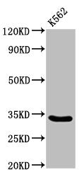 Western Blot  | Positive WB detected in: K562 whole cell lysate  | All lanes: PEX26 antibody at 3.4µg/ml  | Secondary  | Goat polyclonal to rabbit IgG at 1/50000 dilution  | Predicted band size: 34, 29 kDa  | Observed band size: 34 kDaRabbit anti-Human PEX26 Polyclonal Antibody