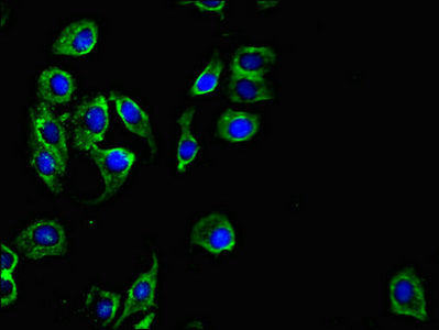Immunofluorescent analysis of A549 cells using PKD1L3 Antibody at dilution of 1:100 and Alexa Fluor 488-congugated AffiniPure Goat Anti-Rabbit IgG(H+L)Rabbit anti-Human PKD1L3 Polyclonal Antibody