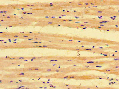 Immunohistochemistry of paraffin-embedded human heart tissue using PKD1L3 Antibody at dilution of 1:100Rabbit anti-Human PKD1L3 Polyclonal Antibody