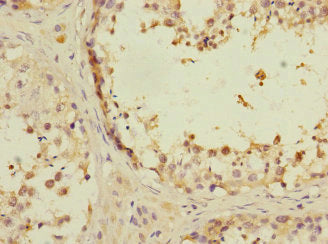 Immunohistochemistry of paraffin-embedded human testis tissue using ANKS1B Antibody at dilution of 1:100Rabbit anti-Human ANKS1B Polyclonal Antibody