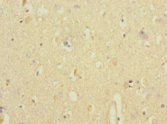 Immunohistochemistry of paraffin-embedded human brain tissue using ANKS1B Antibody at dilution of 1:100Rabbit anti-Human ANKS1B Polyclonal Antibody