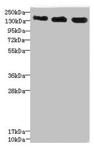 Western blot  | All lanes: ANKS1B antibody at 5.28µg/ml  | Lane 1: 293T whole cell lysate  | Lane 2: HepG2 whole cell lysate  | Lane 3: Hela whole cell lysate  | Secondary  | Goat polyclonal to rabbit IgG at 1/10000 dilution  | Predicted band size: 139, 49, 58, 53, 52, 86, 48, 41, 29, 45 kDa  | Observed band size: 139 kDaRabbit anti-Human ANKS1B Polyclonal Antibody