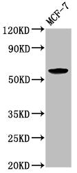 Western Blot | Positive WB detected in: MCF-7 whole cell lysate | All lanes: ILDR1 antibody at 2.6μg/ml | Secondary | Goat polyclonal to rabbit IgG at 1/50000 dilution | Predicted band size: 63, 58, 31, 24, 53, 60 kDa | Observed band size: 63 kDaRabbit anti-Human ILDR1 Polyclonal Antibody
