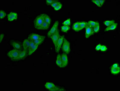 Immunofluorescence staining of HepG2 cells with NIT1 Antibody at 1:400, counter-stained with DAPI. The cells were fixed in 4% formaldehyde, permeabilized using 0.2% Triton X-100 and blocked in 10% normal Goat Serum. The cells were then incubated with the antibody overnight at 4°C. The secondary antibody was Alexa Fluor 488-congugated AffiniPure Goat Anti-Rabbit IgG(H+L).Rabbit anti-Human NIT1 Polyclonal Antibody