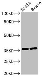Western Blot  | Positive WB detected in: Mouse brain tissue, Rat brain tissue  | All lanes: NIT1 antibody at 3µg/ml  | Secondary  | Goat polyclonal to rabbit IgG at 1/50000 dilution  | Predicted band size: 36, 32, 41, 35, 27 kDa  | Observed band size: 36 kDaRabbit anti-Human NIT1 Polyclonal Antibody