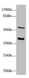 Western Blot  | All lanes: CALHM3 antibody at 8µg/ml + Mouse kidney tissue  | Secondary  | Goat polyclonal to rabbit IgG at 1/10000 dilution  | Predicted band size: 40, 39 kDa  | Observed band size: 40, 55 kDa