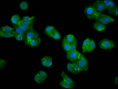 Immunofluorescence staining of HepG2 cells with VRK2 Antibody at 1:200, counter-stained with DAPI. The cells were fixed in 4% formaldehyde, permeabilized using 0.2% Triton X-100 and blocked in 10% normal Goat Serum. The cells were then incubated with the antibody overnight at 4°C. The secondary antibody was Alexa Fluor 488-congugated AffiniPure Goat Anti-Rabbit IgG(H+L).Rabbit anti-Human VRK2 Polyclonal Antibody