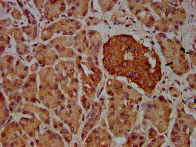 IHC image of VRK2 Antibody diluted at 1:600 and staining in paraffin-embedded human pancreatic tissue performed on a Leica BondTM system. After dewaxing and hydration, antigen retrieval was mediated by high pressure in a citrate buffer (pH 6.0). Section was blocked with 10% normal goat serum 30min at RT. Then primary antibody (1% BSA) was incubated at 4°C overnight. The primary is detected by a biotinylated secondary antibody and visualized using an HRP conjugated SP system.Rabbit anti-Human VRK2 Polyclonal Antibody
