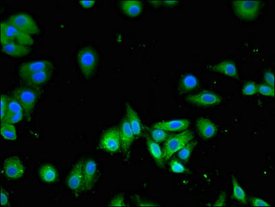 Immunofluorescent analysis of HepG2 cells using SLC13A5 Antibody at dilution of 1:100 and Alexa Fluor 488-congugated AffiniPure Goat Anti-Rabbit IgG(H+L)Rabbit anti-Human SLC13A5 Polyclonal Antibody