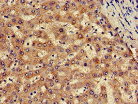 Immunohistochemistry of paraffin-embedded human liver tissue using SLC13A5 Antibody at dilution of 1:100Rabbit anti-Human SLC13A5 Polyclonal Antibody
