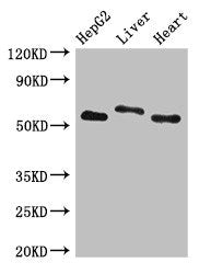 Western Blot | Positive WB detected in: HepG2 whole cell lysate, Rat liver tissue, Mouse heart tissue | All lanes: SLC13A5 antibody at 2.7μg/ml | Secondary | Goat polyclonal to rabbit IgG at 1/50000 dilution | Predicted band size: 64, 59, 62 kDa | Observed band size: 64, 59 kDaRabbit anti-Human SLC13A5 Polyclonal Antibody