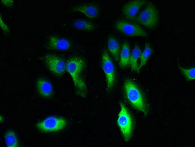 Immunofluorescent analysis of A549 cells using TRPM8 Antibody at dilution of 1:100 and Alexa Fluor 488-congugated AffiniPure Goat Anti-Rabbit IgG(H+L)Rabbit anti-Human TRPM8 Polyclonal Antibody