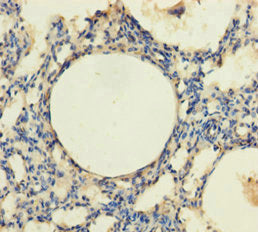 Immunohistochemistry of paraffin-embedded human lung tissue using TRPM8 Antibody at dilution of 1:100Rabbit anti-Human TRPM8 Polyclonal Antibody