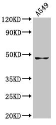 Western Blot  | Positive WB detected in: A549 whole cell lysate  | All lanes: GDF7 antibody at 7.9µg/ml  | Secondary  | Goat polyclonal to rabbit IgG at 1/50000 dilution  | Predicted band size: 47 kDa  | Observed band size: 47 kDaRabbit anti-Human GDF7 Polyclonal Antibody