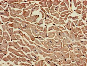 Immunohistochemistry of paraffin-embedded human heart tissue using RAI1 Antibody at dilution of 1:100Rabbit anti-Human RAI1 Polyclonal Antibody