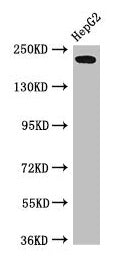 Western Blot  | Positive WB detected in: HepG2 whole cell lysate  | All lanes: RAI1 antibody at 3µg/ml  | Secondary  | Goat polyclonal to rabbit IgG at 1/50000 dilution  | Predicted band size: 204, 199, 176, 105 kDa  | Observed band size: 204 kDaRabbit anti-Human RAI1 Polyclonal Antibody
