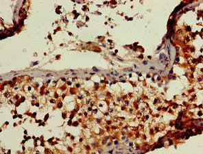 Immunohistochemistry of paraffin-embedded human testis tissue using RBBP6 Antibody at dilution of 1:100