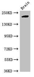 Western Blot | Positive WB detected in: Mouse brain tissue | All lanes: RBBP6 antibody at 2.7μg/ml | Secondary | Goat polyclonal to rabbit IgG at 1/50000 dilution | Predicted band size: 202, 198, 14, 107 kDa | Observed band size: 202 kDa