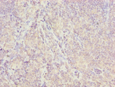 Immunohistochemistry of paraffin-embedded human tonsil tissue using ISCA2 Antibody at dilution of 1:100