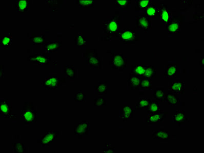 Immunofluorescence staining of U251 cells with PRPF39 Antibody at 1:166, counter-stained with DAPI. The cells were fixed in 4% formaldehyde, permeabilized using 0.2% Triton X-100 and blocked in 10% normal Goat Serum. The cells were then incubated with the antibody overnight at 4°C. The secondary antibody was Alexa Fluor 488-congugated AffiniPure Goat Anti-Rabbit IgG(H+L).Rabbit anti-Human PRPF39 Polyclonal Antibody