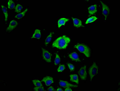 Immunofluorescence staining of A549 cells with EVC2 Antibody at 1:66, counter-stained with DAPI. The cells were fixed in 4% formaldehyde, permeabilized using 0.2% Triton X-100 and blocked in 10% normal Goat Serum. The cells were then incubated with the antibody overnight at 4°C. The secondary antibody was Alexa Fluor 488-congugated AffiniPure Goat Anti-Rabbit IgG(H+L).Rabbit anti-Human EVC2 Polyclonal Antibody