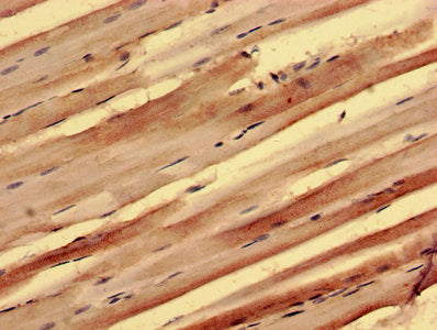 Immunohistochemistry of paraffin-embedded human skeletal muscle tissue using PPP1R3B Antibody at dilution of 1:100Rabbit anti-Human PPP1R3B Polyclonal Antibody