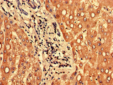 Immunohistochemistry of paraffin-embedded human liver tissue using PPP1R3B Antibody at dilution of 1:100Rabbit anti-Human PPP1R3B Polyclonal Antibody