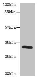 Western blot  | All lanes: PPP1R3B antibody at 6µg/ml + Mouse liver tissue  | Secondary  | Goat polyclonal to rabbit IgG at 1/10000 dilution  | Predicted band size: 33 kDa  | Observed band size: 33 kDaRabbit anti-Human PPP1R3B Polyclonal Antibody