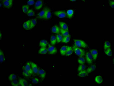 Immunofluorescence staining of Hela cells with PTOV1 Antibody at 1:66, counter-stained with DAPI. The cells were fixed in 4% formaldehyde, permeabilized using 0.2% Triton X-100 and blocked in 10% normal Goat Serum. The cells were then incubated with the antibody overnight at 4°C. The secondary antibody was Alexa Fluor 488-congugated AffiniPure Goat Anti-Rabbit IgG(H+L).Rabbit anti-Human PTOV1 Polyclonal Antibody