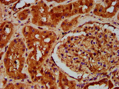 IHC image of the antibody diluted at 1:200 and staining in paraffin-embedded human kidney tissue performed on a Leica BondTM system. After dewaxing and hydration, antigen retrieval was mediated by high pressure in a citrate buffer (pH 6.0). Section was blocked with 10% normal goat serum 30min at RT. Then primary antibody (1% BSA) was incubated at 4°C overnight. The primary is detected by a biotinylated secondary antibody and visualized using an HRP conjugated SP system.Rabbit anti-Human PTOV1 Polyclonal Antibody