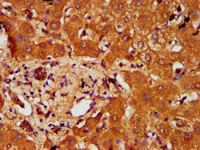 IHC image of PTOV1 Antibody diluted at 1:200 and staining in paraffin-embedded human liver tissue performed on a Leica BondTM system. After dewaxing and hydration, antigen retrieval was mediated by high pressure in a citrate buffer (pH 6.0). Section was blocked with 10% normal goat serum 30min at RT. Then primary antibody (1% BSA) was incubated at 4°C overnight. The primary is detected by a biotinylated secondary antibody and visualized using an HRP conjugated SP system.Rabbit anti-Human PTOV1 Polyclonal Antibody