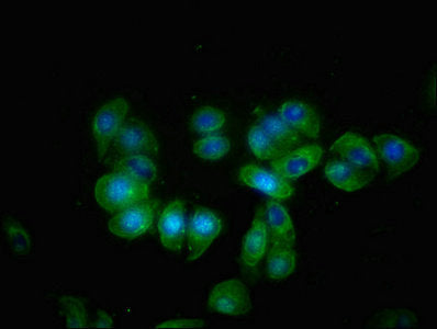 Immunofluorescence staining of HepG2 cells with KLB Antibody at 1:66, counter-stained with DAPI. The cells were fixed in 4% formaldehyde, permeabilized using 0.2% Triton X-100 and blocked in 10% normal Goat Serum. The cells were then incubated with the antibody overnight at 4°C. The secondary antibody was Alexa Fluor 488-congugated AffiniPure Goat Anti-Rabbit IgG(H+L).
