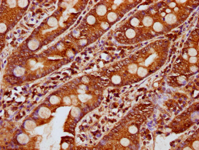 IHC image of the antibody diluted at 1:200 and staining in paraffin-embedded human small intestine tissue performed on a Leica BondTM system. After dewaxing and hydration, antigen retrieval was mediated by high pressure in a citrate buffer (pH 6.0). Section was blocked with 10% normal goat serum 30min at RT. Then primary antibody (1% BSA) was incubated at 4°C overnight. The primary is detected by a biotinylated secondary antibody and visualized using an HRP conjugated SP system.