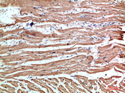 Immunohistochemical analysis of paraffin-embedded human-heart, antibody was diluted at 1:200Rabbit anti-Human NLRX1 Polyclonal Antibody