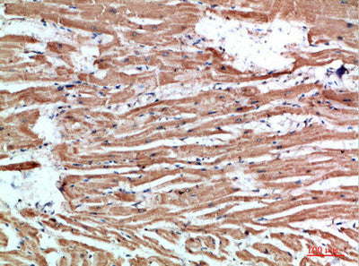 Immunohistochemical analysis of paraffin-embedded human-heart, antibody was diluted at 1:200Rabbit anti-Human NLRX1 Polyclonal Antibody