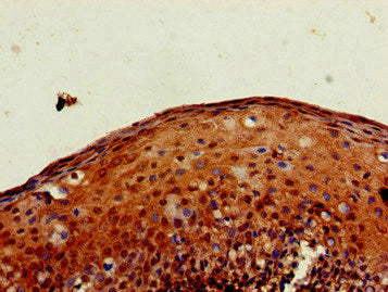 Immunohistochemistry of paraffin-embedded human tonsil tissue using PXK Antibody at dilution of 1:100Rabbit anti-Human PXK Polyclonal Antibody