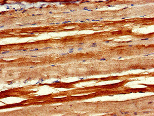 Immunohistochemistry of paraffin-embedded human skeletal muscle tissue using PXK Antibody at dilution of 1:100Rabbit anti-Human PXK Polyclonal Antibody