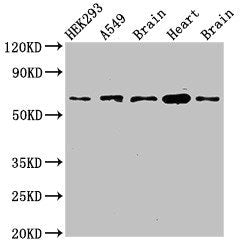 Western Blot  | Positive WB detected in: HEK293 whole cell lysate, A549 whole cell lysate, Mouse brain tissue, Mouse heart tissue, Rat brain tissue  | All lanes: PXK antibody at 2.7µg/ml  | Secondary  | Goat polyclonal to rabbit IgG at 1/50000 dilution  | Predicted band size: 65, 59, 39, 63, 50, 61, 56 kDa  | Observed band size: 65 kDaRabbit anti-Human PXK Polyclonal Antibody