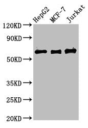 Western Blot  | Positive WB detected in: HepG2 whole cell lysate, MCF-7 whole cell lysate, Jurkat whole cell lysate  | All lanes: PRUNE1 antibody at 4µg/ml  | Secondary  | Goat polyclonal to rabbit IgG at 1/50000 dilution  | Predicted band size: 51, 43, 31, 27, 25, 19 kDa  | Observed band size: 60 kDaRabbit anti-Human PRUNE1 Polyclonal Antibody