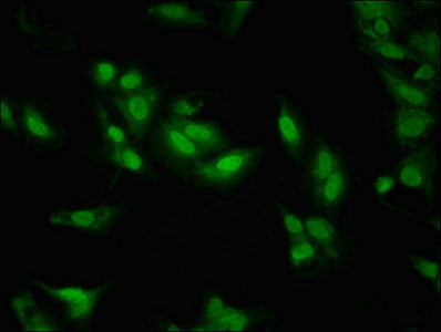 Immunofluorescent analysis of Hela cells using LDB1 Antibody at dilution of 1:100 and Alexa Fluor 488-congugated AffiniPure Goat Anti-Rabbit IgG(H+L)