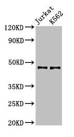 Western Blot  | Positive WB detected in: Jurkat whole cell lysate, K562 whole cell lysate  | All lanes: LDB1 antibody at 3.2µg/ml  | Secondary  | Goat polyclonal to rabbit IgG at 1/50000 dilution  | Predicted band size: 47, 37, 43 kDa  | Observed band size: 47 kDa