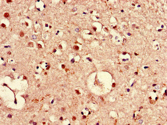 Immunohistochemistry of paraffin-embedded human brain tissue using PIM3 Antibody at dilution of 1:100Rabbit anti-Human PIM3 Polyclonal Antibody