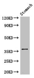 Western Blot | Positive WB detected in: Mouse stomach tissue | All lanes: PIM3 antibody at 3.4μg/ml | Secondary | Goat polyclonal to rabbit IgG at 1/50000 dilution | Predicted band size: 36 kDa | Observed band size: 36 kDaRabbit anti-Human PIM3 Polyclonal Antibody